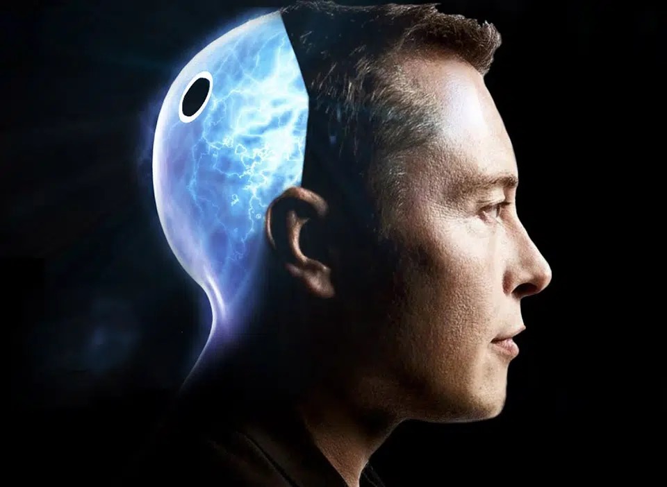 Neuralink của Elon Musk đăng video khỉ chơi game bằng suy nghĩ