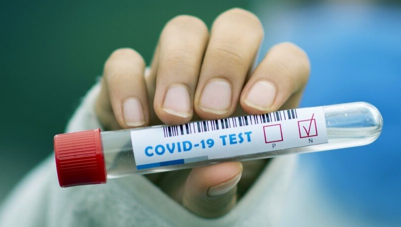 Tăng cường kiểm tra, kiểm soát mặt hàng Kit test Covid-19