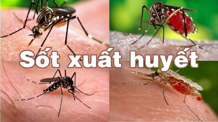 Những việc NÊN và KHÔNG NÊN làm khi trẻ mắc sốt xuất huyết