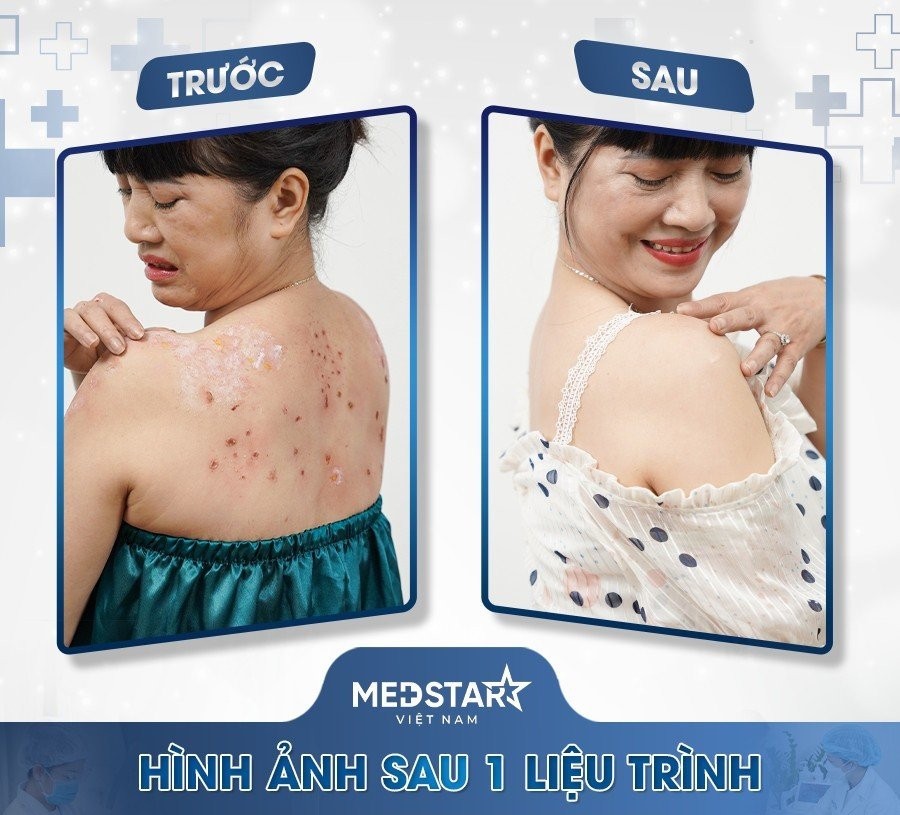 Medstar Việt Nam tiên phong ứng dụng công nghệ Phytosome bảo vệ Da