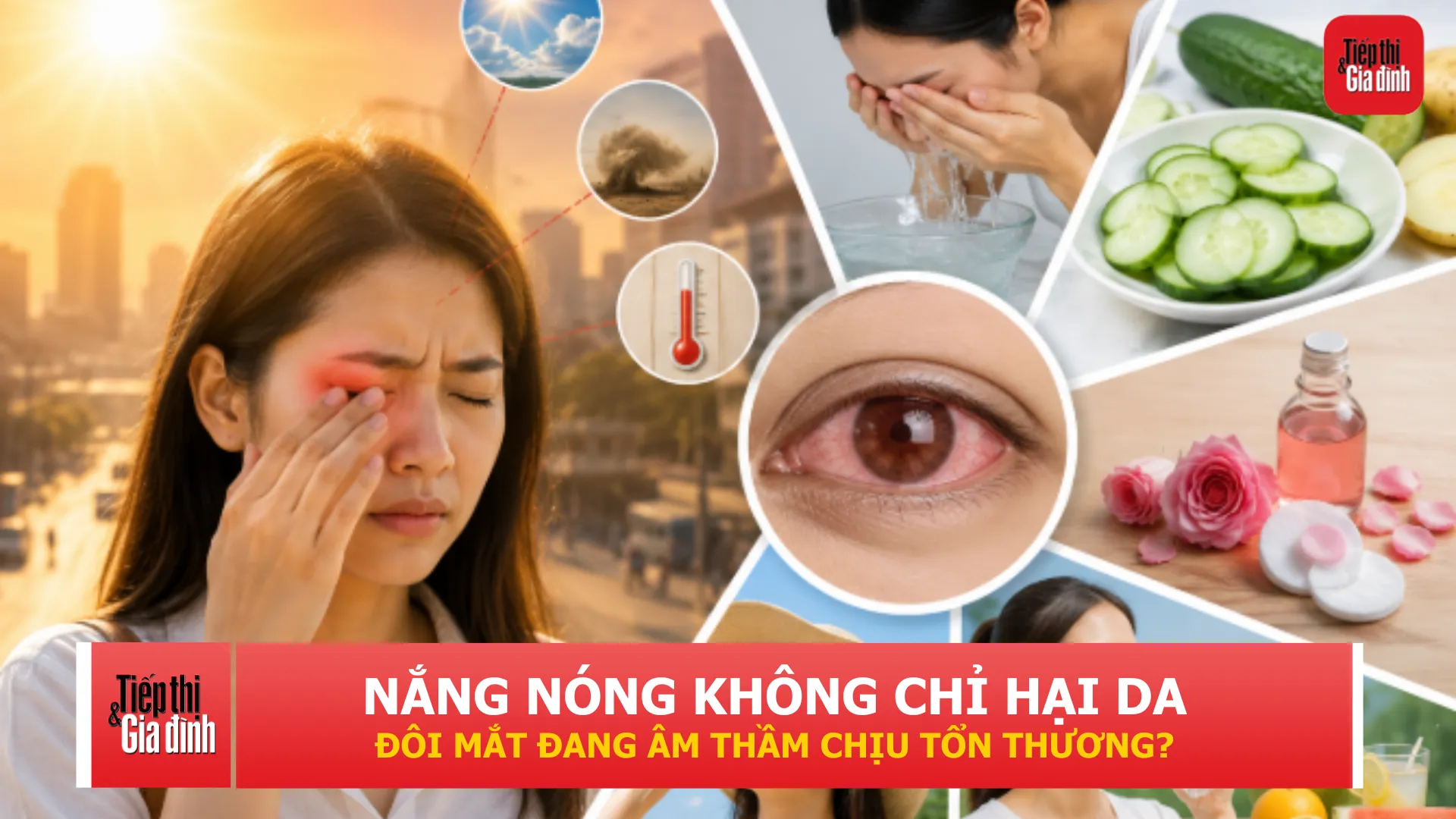 Nắng nóng kéo dài, dấu hiệu này ở mắt không nên xem thường