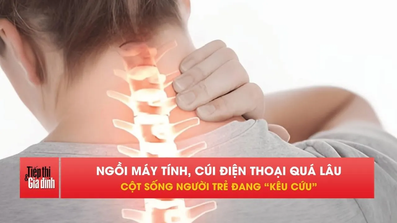 Người trẻ đau cổ vai gáy tăng báo động vì thói quen này