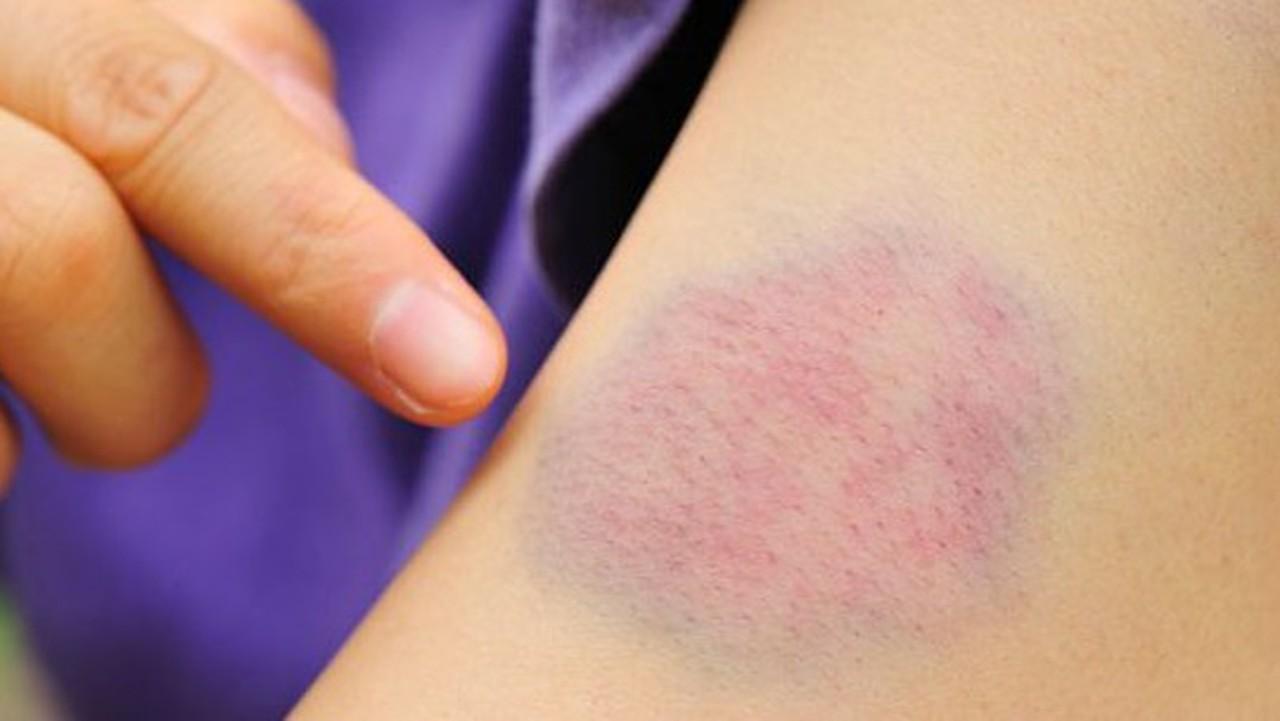 6 dấu hiệu bất thường trên da có thể là lời cảnh báo sức khỏe, đừng chủ quan bỏ qua