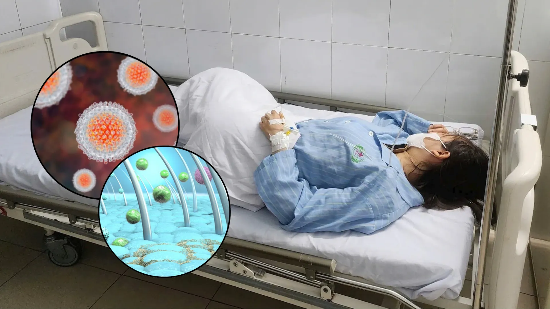7 loại virus dễ làm tăng nguy cơ ung thư và cách phòng ngừa hiệu quả