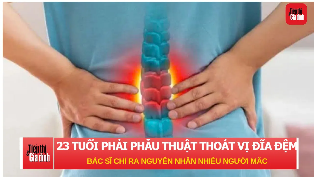 Mới 23 tuổi đã phải phẫu thuật thoát vị đĩa đệm, bác sĩ chỉ ra nguyên nhân nhiều người mắc phải