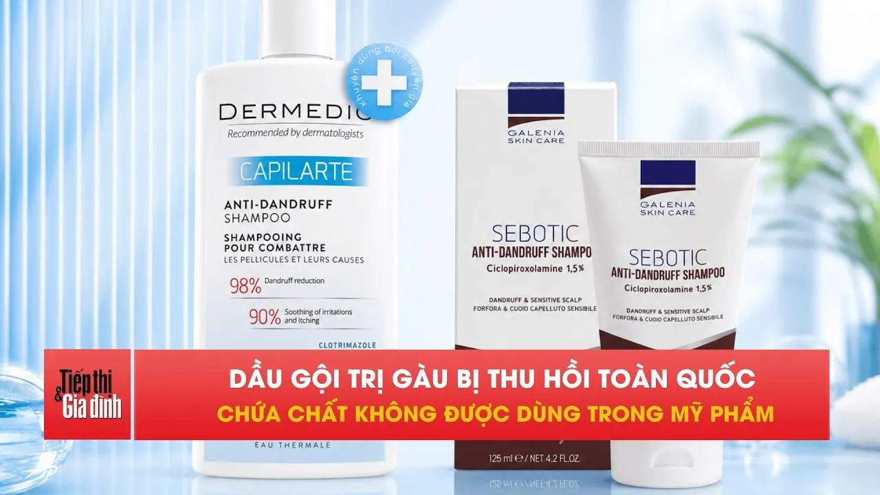 Thu hồi 4 dầu gội trị gàu chứa chất cấm, nhiều người đang dùng