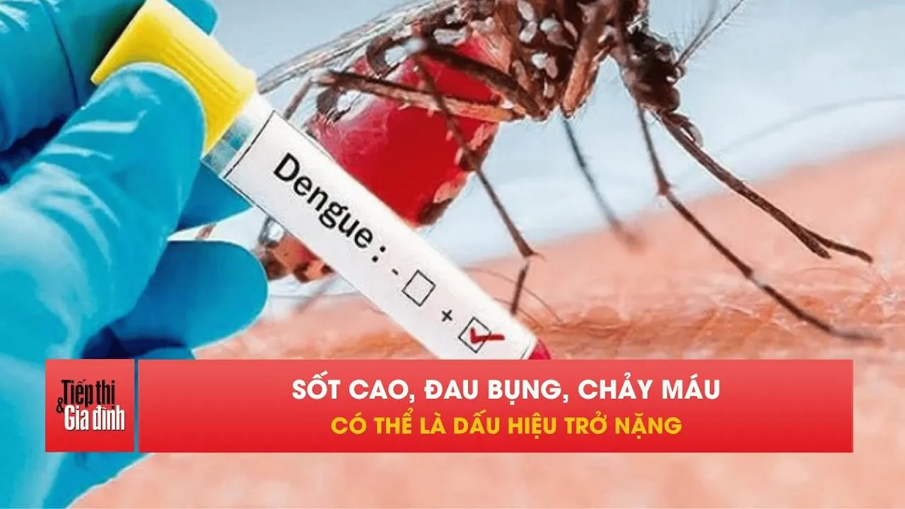 Sốt xuất huyết Dengue nguy hiểm thế nào mà nhiều người chủ quan?