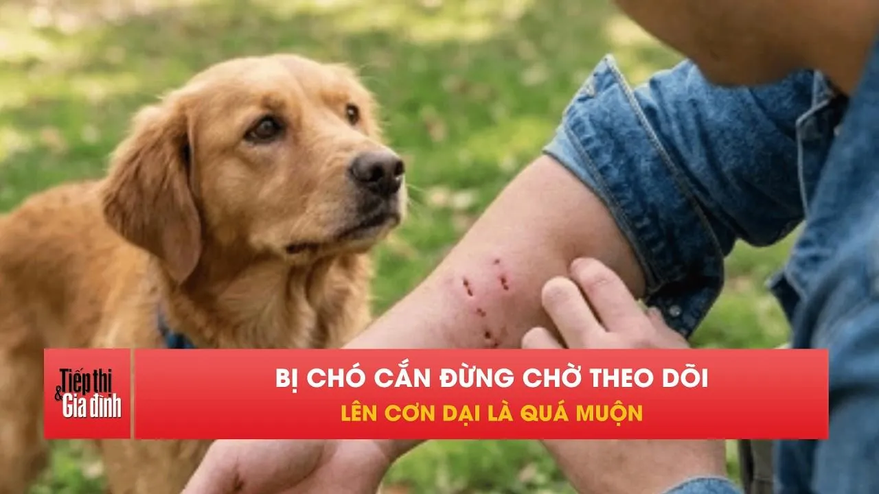 Bị chó cắn phải làm gì? Đừng để quá muộn khi bệnh dại đã phát tác.