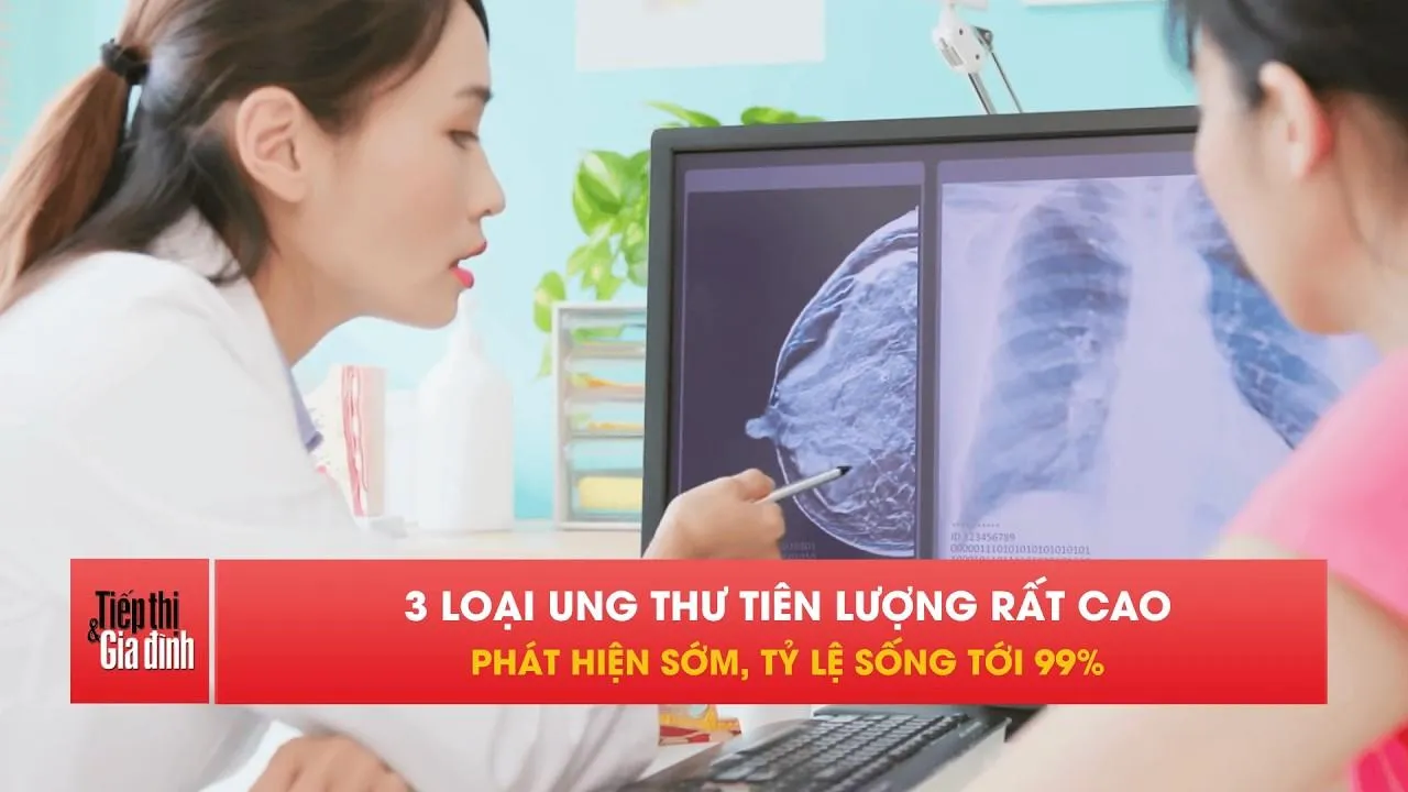 3 loại ung thư phát hiện sớm, cơ hội sống tới 99%