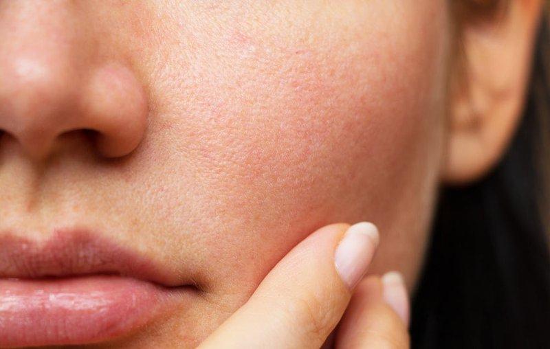Da mịn hơn, lỗ chân lông bớt lộ rõ nhờ 4 bước chăm sóc nhiều người đang bỏ qua