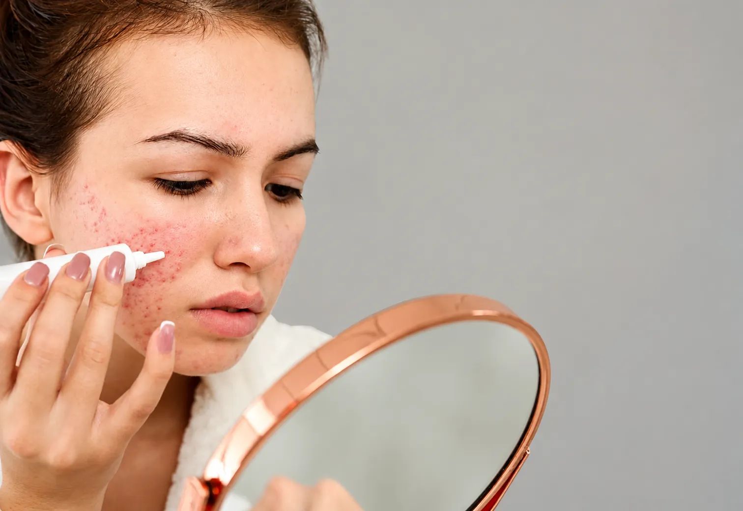Mách bạn cách chọn kem chấm mụn chuẩn y khoa giúp gom cồi, mờ thâm nhanh