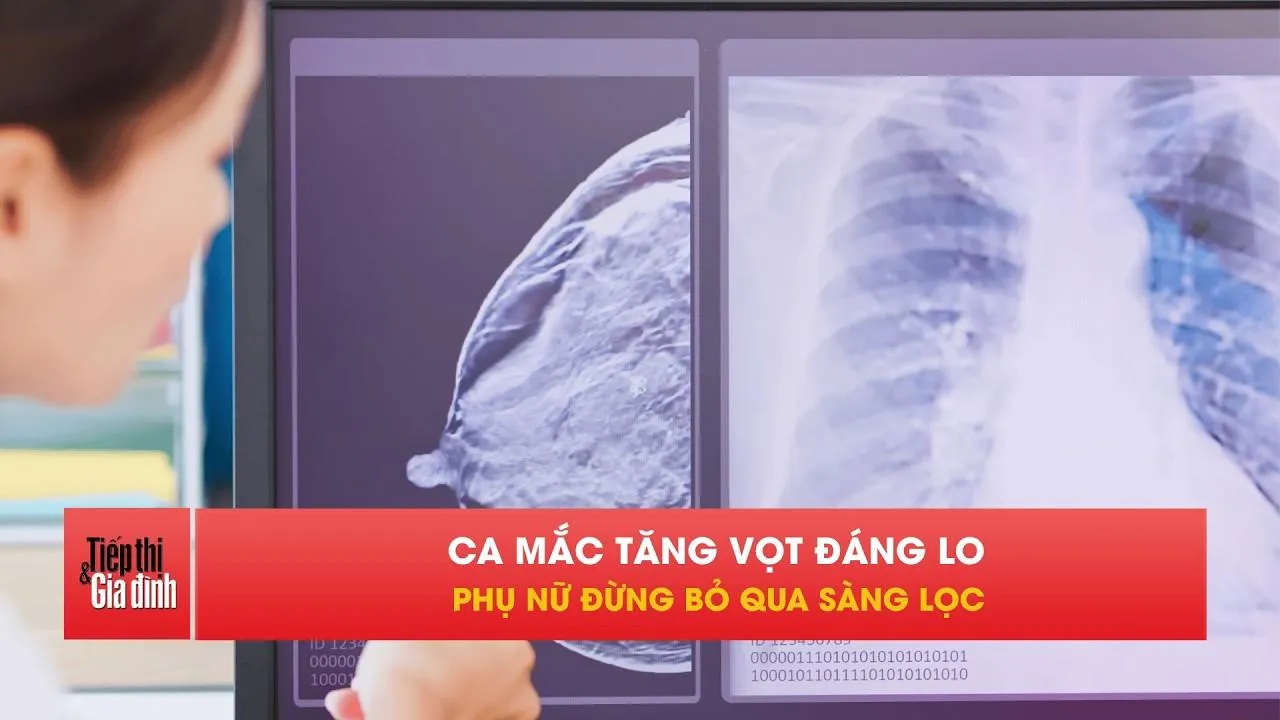 Ung thư vú tăng nhanh bất thường, vượt xa dự báo