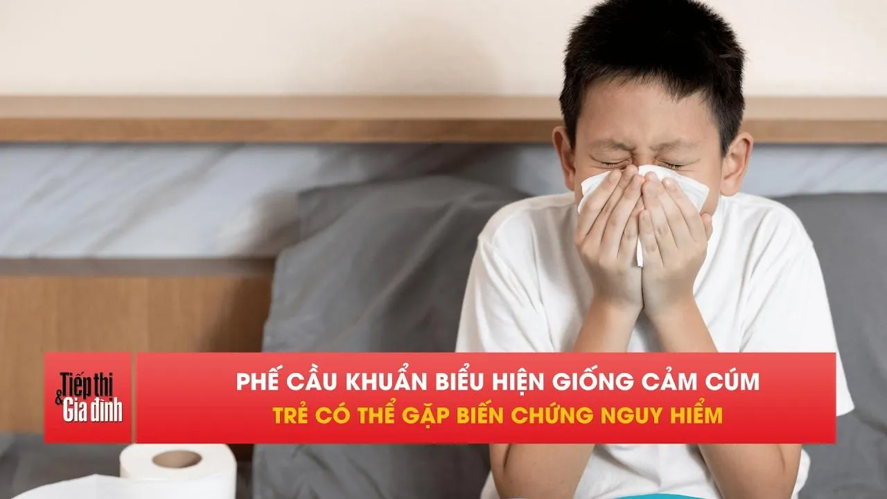 Phế cầu khuẩn ở trẻ: Tưởng cảm cúm, diễn biến nguy hiểm