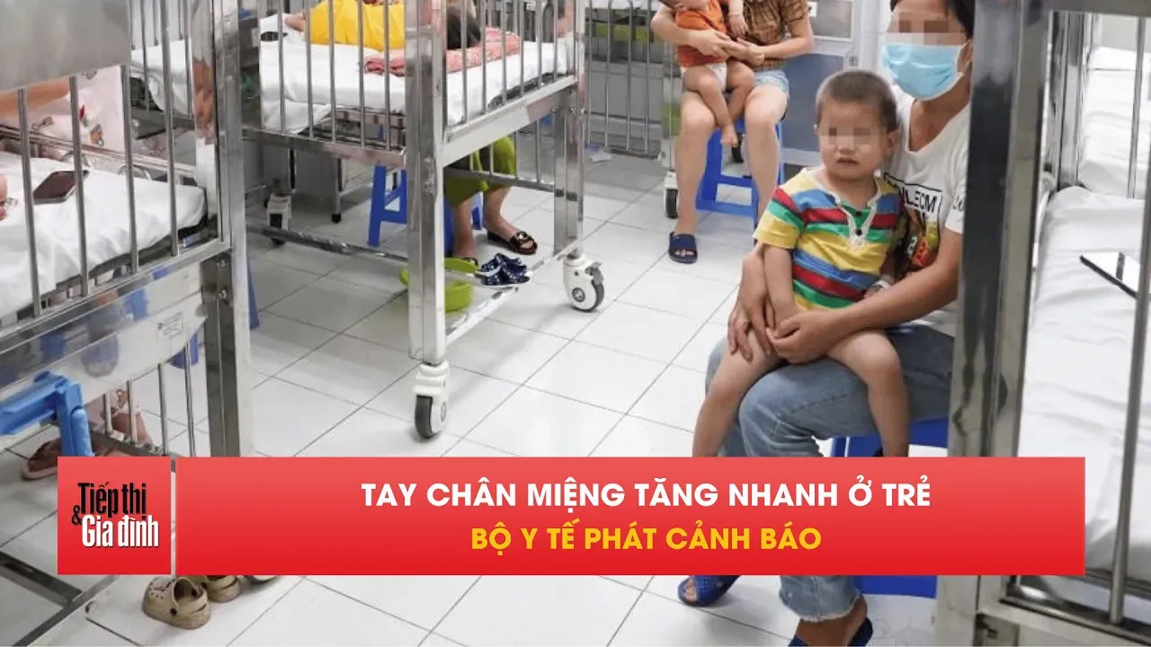 Mỗi tuần 3.000 trẻ mắc tay chân miệng, nguy cơ dịch bùng phát