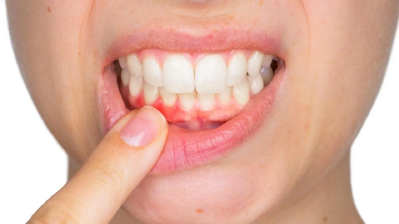 Chăm răng mỗi ngày vẫn sưng nướu: Có thể bạn đang mắc 8 sai lầm này