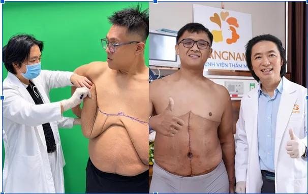 Trọng Nhân và lời cảnh tỉnh về kiểm soát cân nặng sớm đằng sau một “kỷ lục”