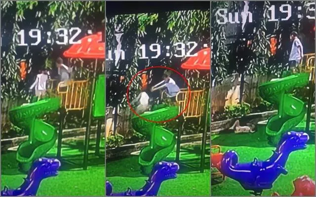 Bé gái 4 tuổi bị đẩy ngã từ cầu trượt gây nứt xương hốc mắt: Bài học cảnh giác cho nhiều phụ huynh